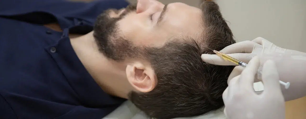 The Remarkable Potential of Platelet-Rich Plasma (PRP) Therapy for Scalp Rejuvenation and Hair Restoration