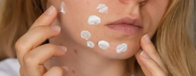 Preglite Stretch Marks and Scars Therapy Lotion