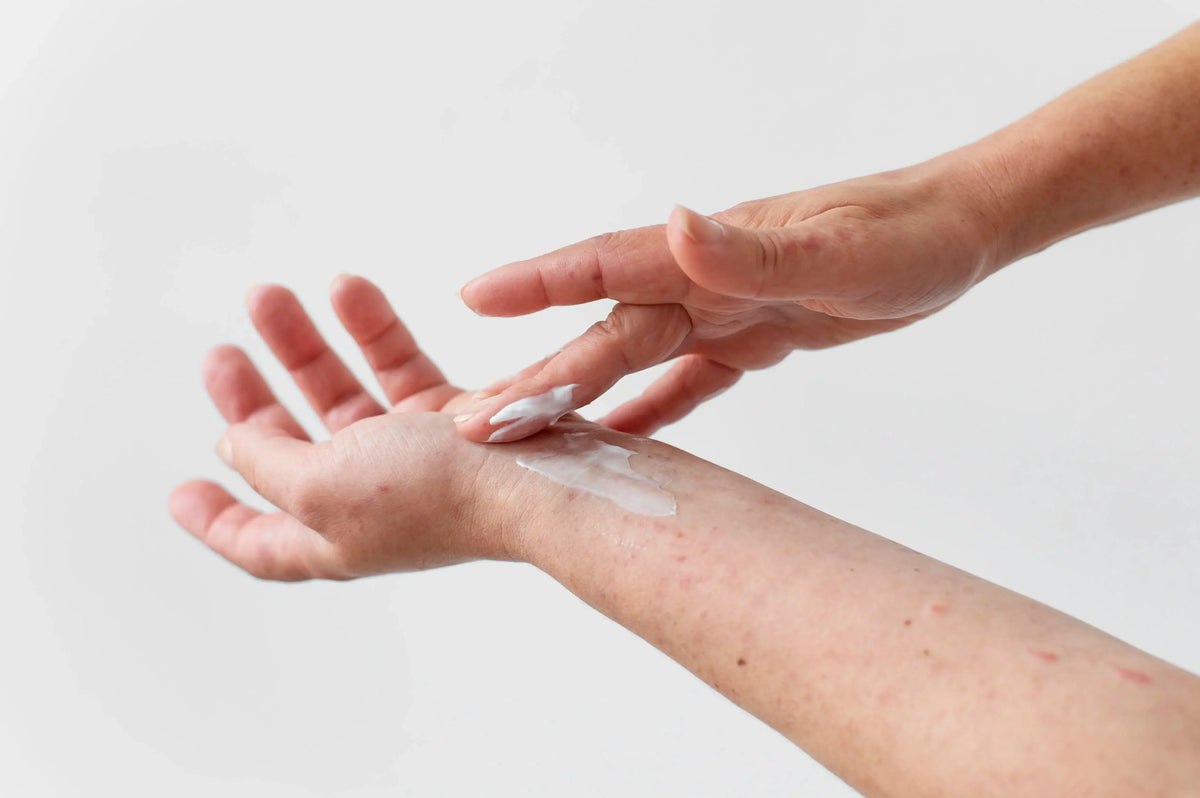 Deep Hydration: Hydrophil Lotion with 10% Urea for Dry Skin
