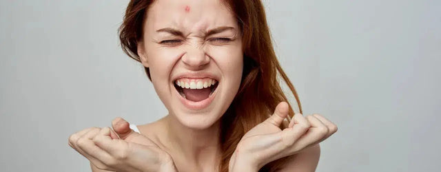 Skin Problems in Teenagers: What You Need to Know
