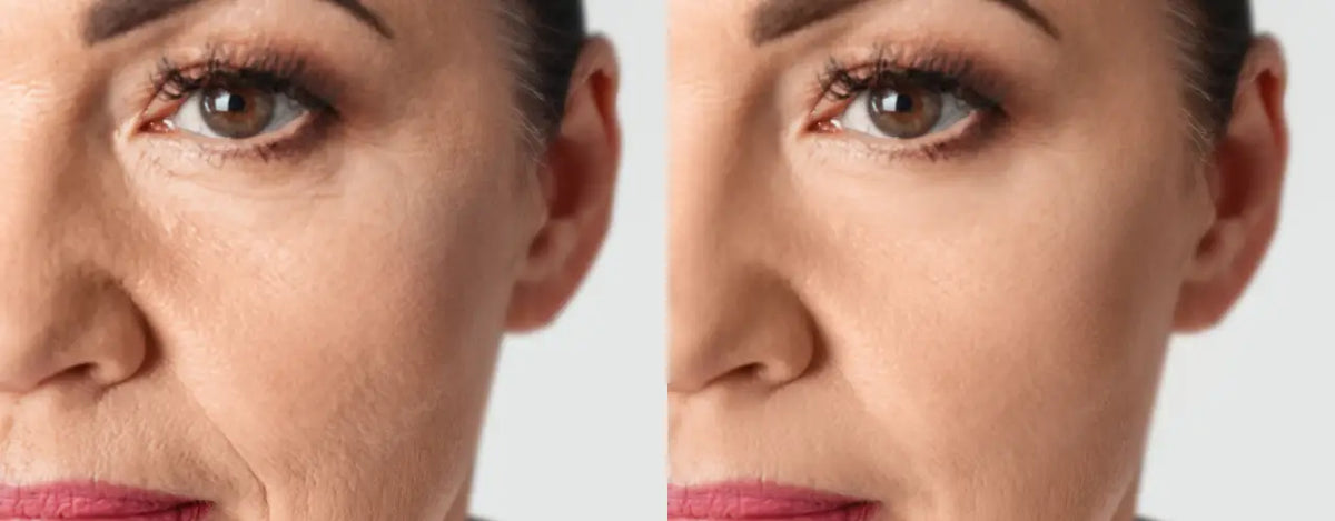Achieve a Fair, Smooth, and Glowing Complexion with Derma-Clin Cream