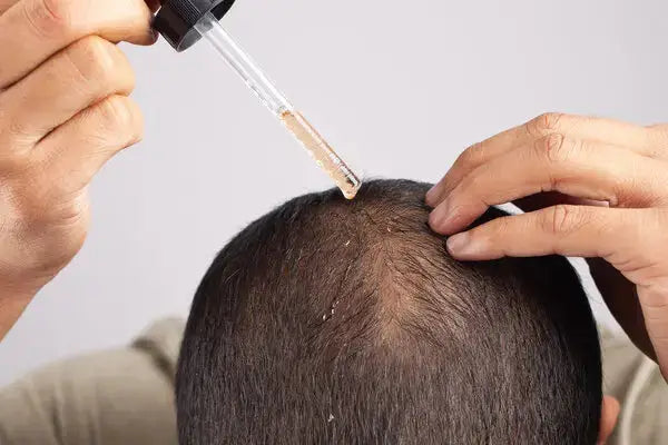 Hair growth serum