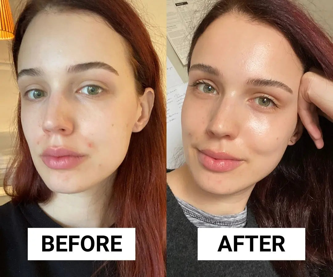 La-Roche-Posay-Products Derma.pk