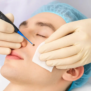 Cautery