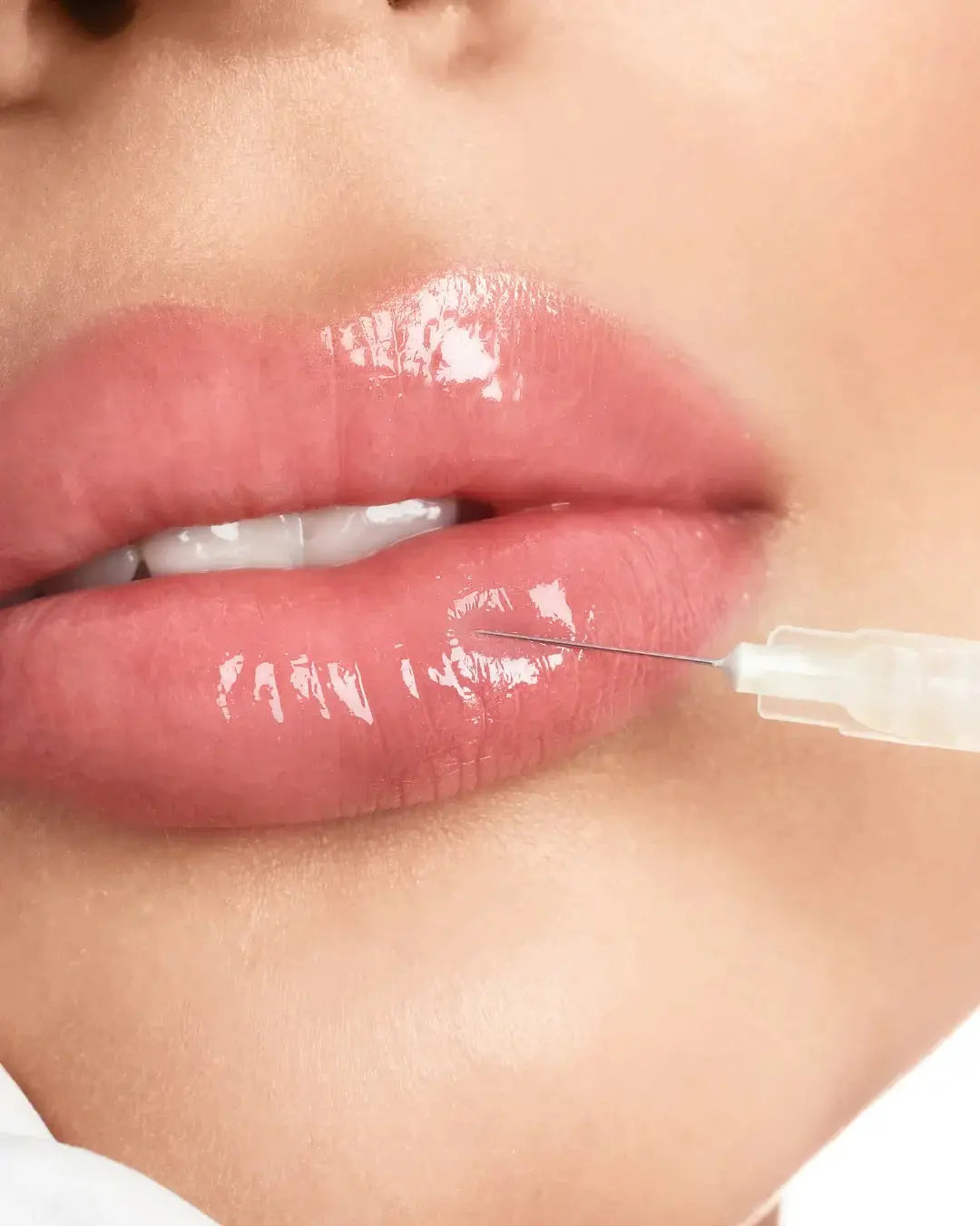Fillers