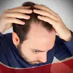 Hair fall and regrowth treatments in Pakistan | Derma.pk