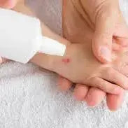 Antiseptics & Wound Care