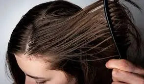 For-Oily-Hair-Scalp Derma.pk