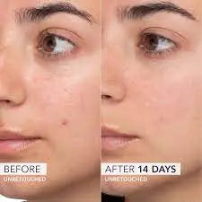 Cream-Hydrating-Cleansers Derma.pk
