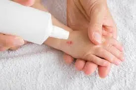 Antiseptics-Wound-Care Derma.pk