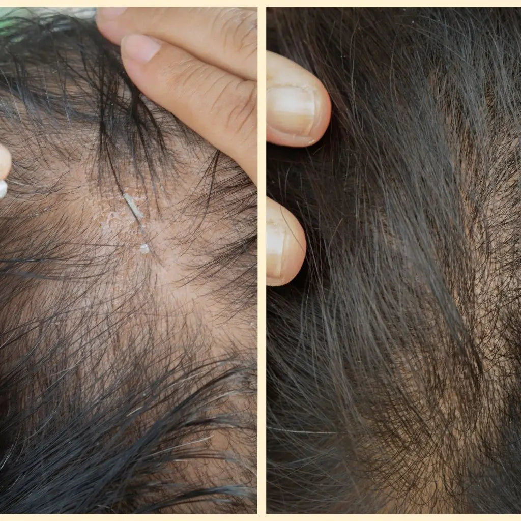 Procapil Derma.pk