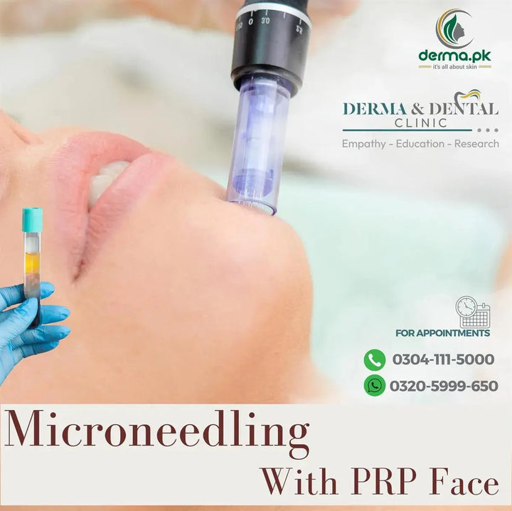 Advanced Facial Rejuvenation: Microneedling with PRP at Derma & Dental Clinic Lahore Derma.pk