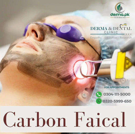 Celebrate Radiant Skin: Unveiling the Science of Carbon Facial with PECO Laser at Derma & Dental Clinic