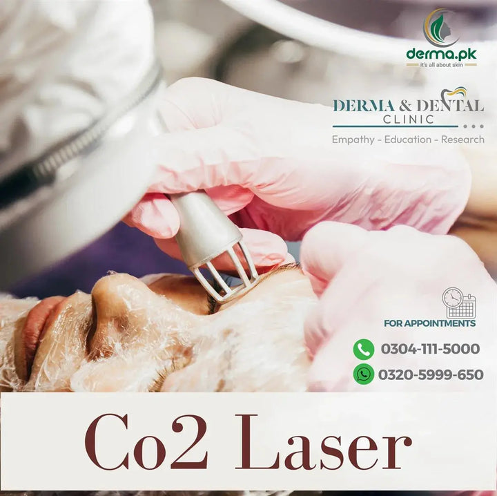 Co2 Laser Skin Rejuvenation: Scientific Approach at Derma & Dental Clinic Derma.pk