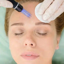 Microneedling Treatment in Bahria Town Lahore | Skin Clinic by Dr. Eram Razzaq photo 1