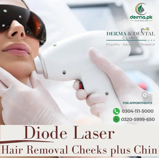 Smooth and Radiant: Diode Laser Hair Removal for Cheeks Plus Chin at Derma & Dental Clinic
