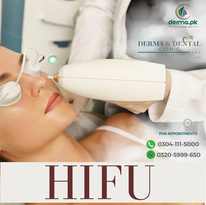 Discover Youthful Radiance with HIFU Skin Rejuvenation at Derma & Dental Clinic Derma.pk