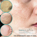Erase Acne Scars and Unveil Your Radiant Skin: Skin Clinic by Dr. Eram Razzaq's Expert Solutions photo 1