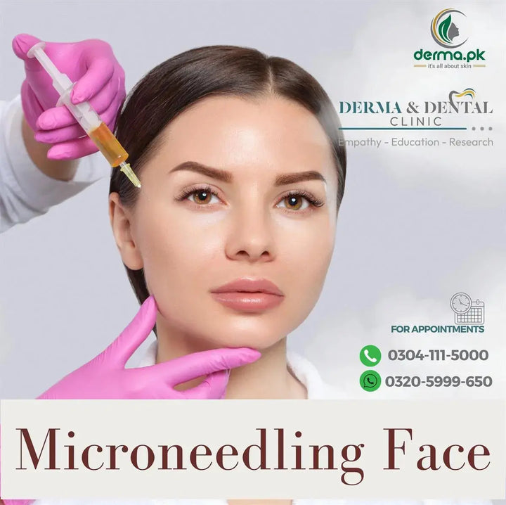 Get Glowing Skin with Microneedling at Derma & Dental Clinic Derma.pk