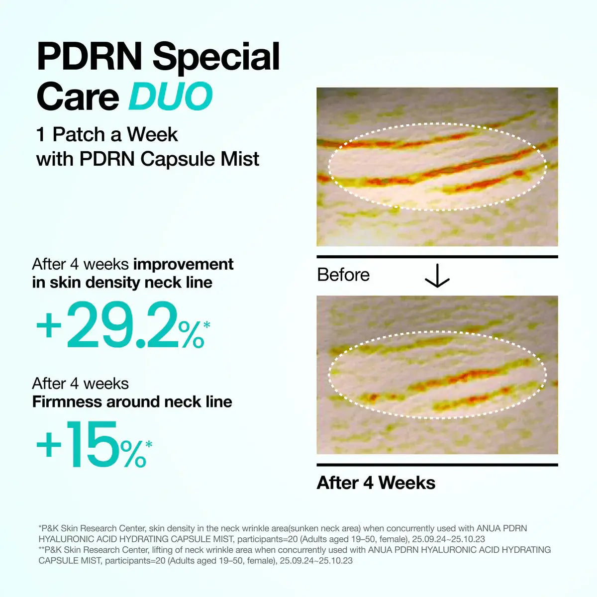 Anua Pdrn Collagen Melting Patch For Neck 4ea – additional product angle