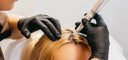 Microneedling with PRP for Hair Restoration | Skin Clinic by Dr. Eram Razzaq Lahore photo 1