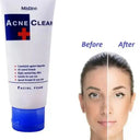 Pack of 2 Mistine Acne Clear Facial Foam and Bioaqua Acne Cream photo 3
