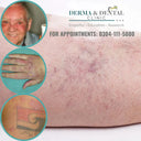 Photodermatitis: Causes, Symptoms, and Treatment Options at Skin Clinic by Dr. Eram Razzaq photo 1