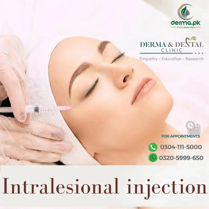 Precision Dermatological Care: Intralesional Injections at Derma & Dental Clinic Derma.pk