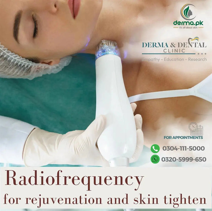 Radiofrequency