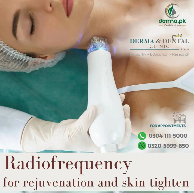 Revitalize Your Radiance: Experience Radiofrequency Skin Tightening & Rejuvenation at Skin Clinic by Dr. Eram Razzaq