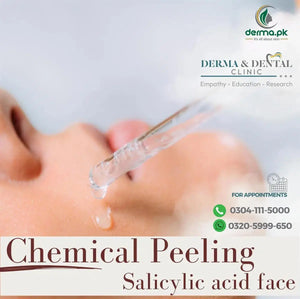 Revitalize Your Skin with Salicylic Acid Face Peeling at Skin Clinic by Dr. Eram Razzaq, Bahria Town Lahore – Buy Online in Pakistan | Derma.pk
