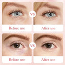 BIOAQUA Rose Eye Cream - Hyaluronic Acid Moisturizing Eye Care - 20g photo 7