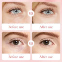BIOAQUA Rose Hyaluronic Acid Moisturizing Eye Mask 30 Pairs 80g photo 5