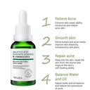 ETAE Venzen Salicylic Acid Essence Acid Pore Moisturizing Face Serum photo 5