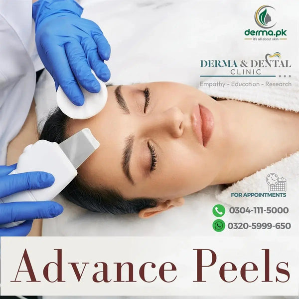 Scientific Skin Renewal: Unveiling Advanced Peels at Derma & Dental Clinic Derma.pk