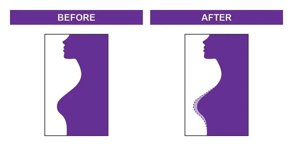 Shape Up Natural Breast Firming Cream - Daily body cream for skin firmness