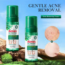 SADOER Tea Tree Acne Clean Mousse - Oil Control Foam Cleanser - 150g photo 3