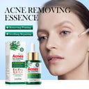 SADOER Tea Tree Serum - Oil Control & Anti-Acne Face Serum - 30ml photo 2