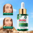 SADOER Tea Tree Serum - Oil Control & Anti-Acne Face Serum - 30ml photo 5