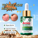 SADOER Tea Tree Serum - Oil Control & Anti-Acne Face Serum - 30ml photo 6