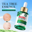 SADOER Tea Tree Serum - Oil Control & Anti-Acne Face Serum - 30ml photo 4