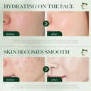 SADOER Tea Tree Acnes Oil Control Face Cream 50g photo 2