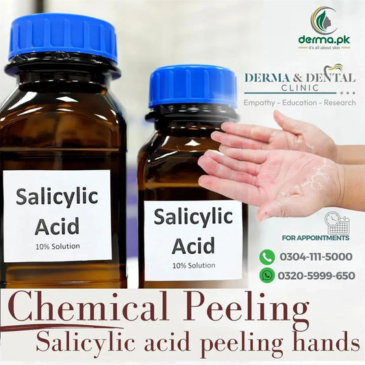 The Science of Hand Rejuvenation: Salicylic Acid Peeling at Derma & Dental Clinic