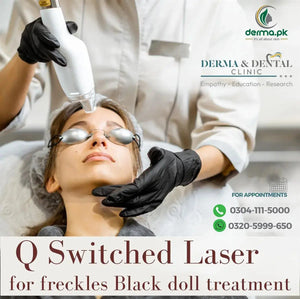 The Science of Q-Switched Laser: Advancing Freckle Treatment at Derma & Dental Clinic