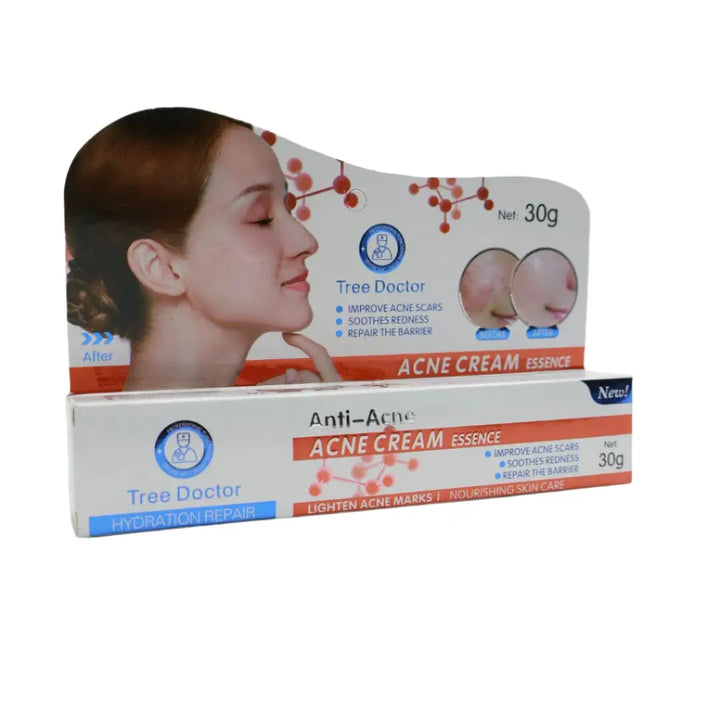 acne cream