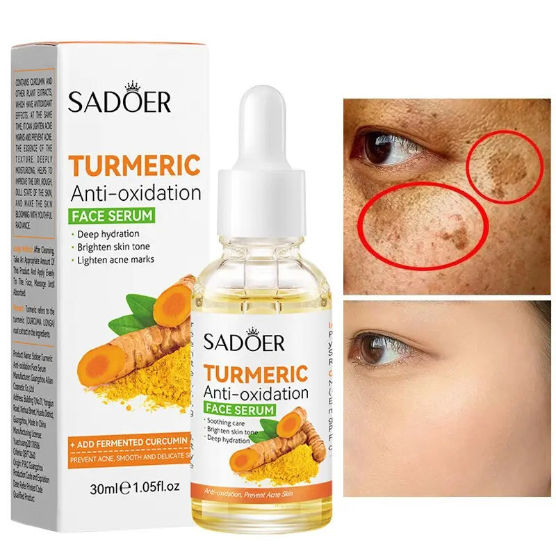 SADOER Turmeric Anti-Oxidation Face Serum - Brighten & Lighten Acne Marks - 30ml