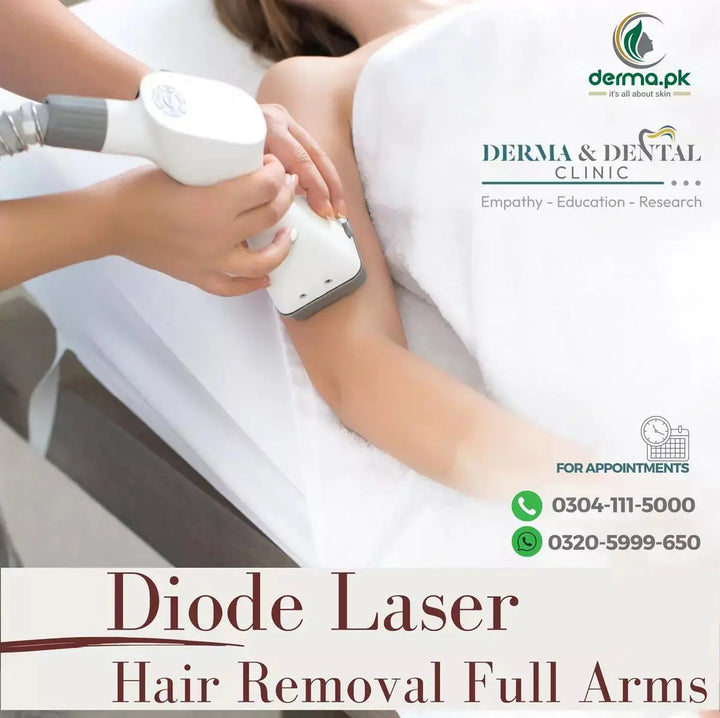 Advanced Diode Laser Hair Removal for Flawless Full Arms Derma.pk