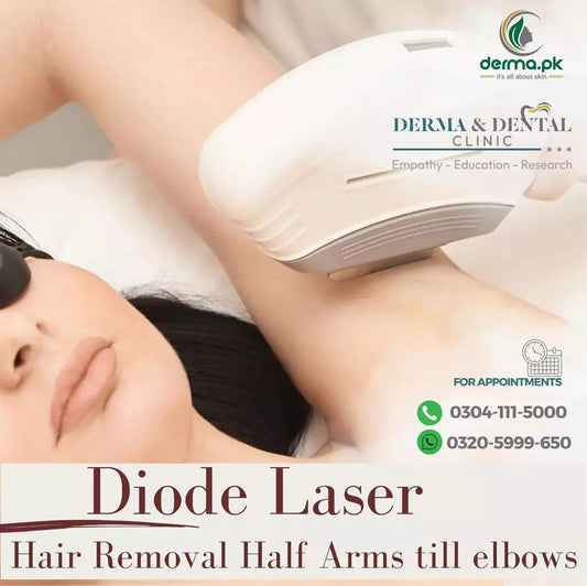Advanced Diode Laser Hair Removal for Half Arms till Elbows - Expert Dermatologist Services at Derma & Dental Clinic