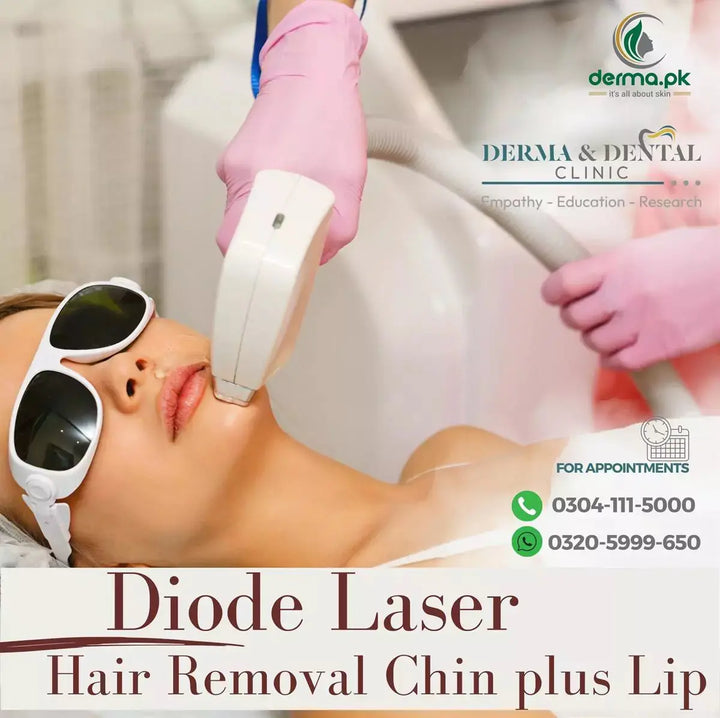 Diode Laser Hair Removal Services: Chin & Lip Derma.pk
