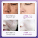 SADOER Nicotinamide Anti-Freckle Whitening Moisturizing Toner - 100ml photo 5